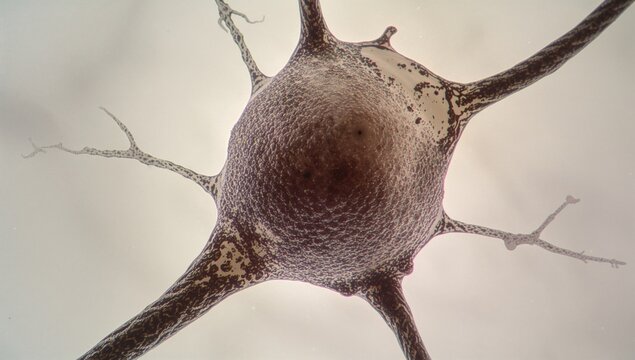 Nissl bodies within the cell body of a large neuron, indicating protein synthesis activity