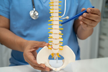 Asian doctor holding spinal nerve and bone model, Lumbar spine displaced herniated disc fragment for treatment medical in the orthopedic department.