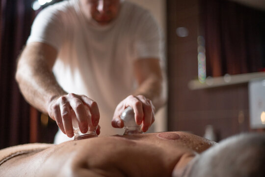 Close up of therapist applying cupping therapy on male clients back during wellness and rehabilitation treatment, traditional alternative medicine for relaxation and pain relief.
