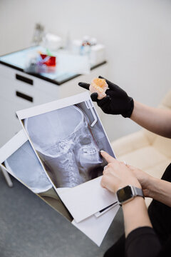 Orthodontic consultation with cephalometric X rays and jaw model, modern dental clinic