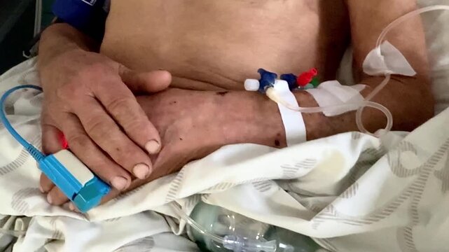 Elderly patient rests in a hospital bed with an iv drip and pulse oximeter attached, symbolizing healthcare, serious illness, and the need for intensive medical treatment
