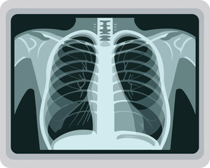 Medical vector illustration of a human chest X-ray showing lungs and rib cage for diagnostic purposes