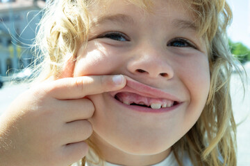 Smiling child with missing teeth. Kid showing tooth gap. Closeup of baby teeth. Child losing milk teeth. Child mouth with new teeth. Kid with toothless smile. Kids missing tooth. Child dental concept.