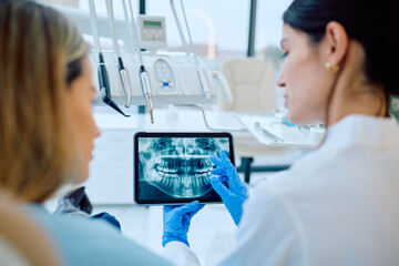 Dentist in blue gloves showing patient panoramic dental x-ray on digital tablet, discussing teeth health in modern office