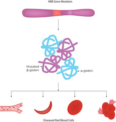 HBB Gene Mutation and Sickle Cell Anemia Pathophysiology Vector Illustration
