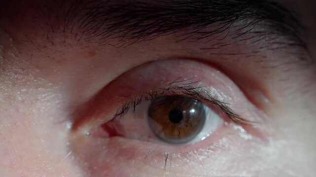 eye closeup details, male eye with subtle movements, detailed examination of eye showing eyelid and redness, highresolution image capturing intricate features and movements of male eye explanation