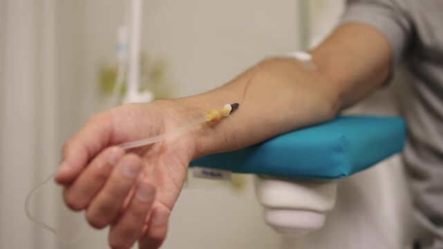 Close-up of patient arm resting on medical padded support while receiving intravenous drip, delivering essential vitamins and medication directly into bloodstream for health and wellness.