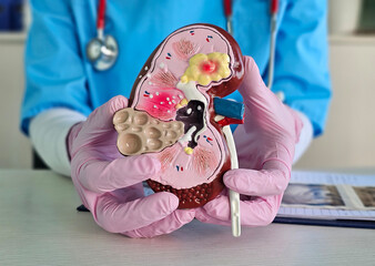 Health professional demonstrates kidney model to explain anatomy concept