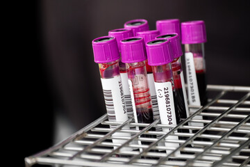Close up of blood samples in test tubes with purple caps arranged in a metal rack at a laboratory. Medical analysis and health testing concept for diagnosis, research, and clinical examination.