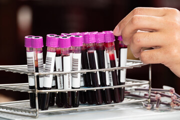 Close up of a laboratory technician’s hand handling blood sample tubes with purple caps in a metal rack. Concept of medical testing, diagnosis, health analysis, and laboratory research.