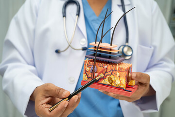 Hair transplant, Asian dermatologist doctor holding skin structure anatomy model for treatment in hospital.