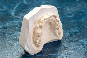 Impression of Dental Arch Model for Orthodontic Applications on Textured Surface © andrei310