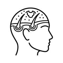 Outline of a human head showing hair follicles and scalp structure