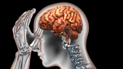 Human Suffering with Severe Headache Anatomy