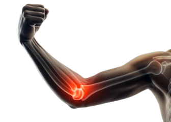 Close-up, realistic image of a human arm with a transparent X-ray effect revealing the bones, specifically focusing on the elbow join isolated on a transparent background.