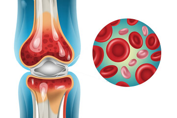 Human knee joint, with magnified view of red blood cells, cutout, PNG isolated on white or transparent background