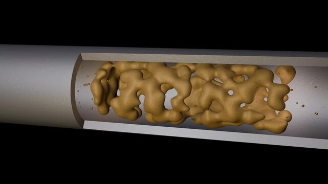 Biofilm accumulation inside tube. Clog in pipe. Atherosclerosis.  Arterial blockage with plaque, cholesterol, debris buildup. 3d animation render.