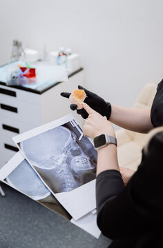 Orthodontic consultation with cephalometric X rays and jaw model, modern dental clinic