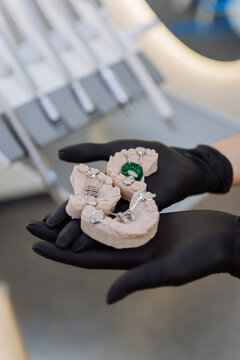 Orthodontic palatal expander models in gloved hands at dental clinic, closeup