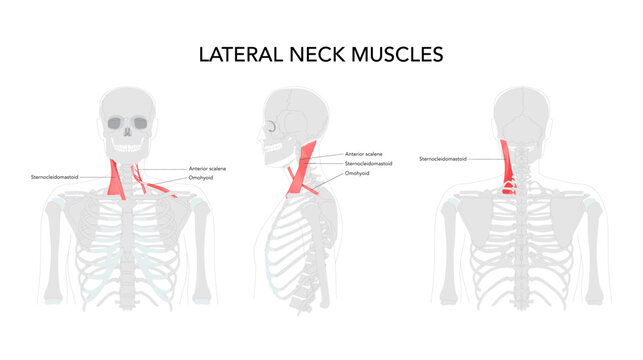 Lateral Neck Muscles - Group of muscles located on the sides of the neck, including the anterior, middle, and posterior scalene muscles, levator scapulae, splenius capitis.