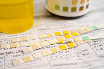 Urinalysis, urine cup with reagent strip pH paper test and comparison chart in laboratory.