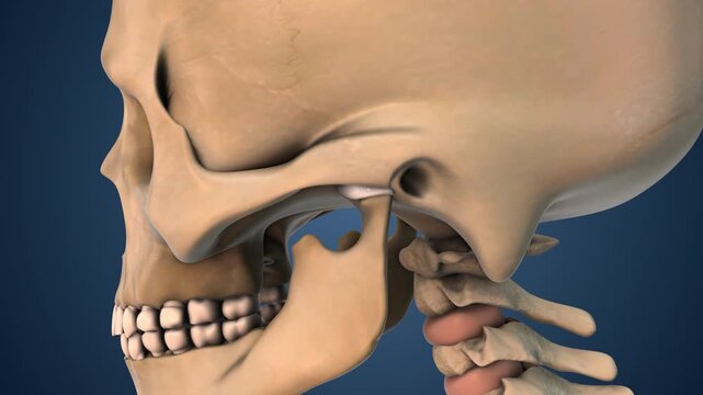 Anatomical Animation of Painful TMJ Joint Dysfunction