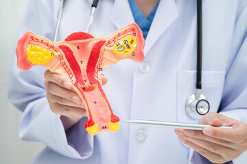 Uterus, doctor holding human anatomy model for study diagnosis and treatment in hospital.