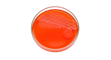 Bacterial Culture in Petri Dish.