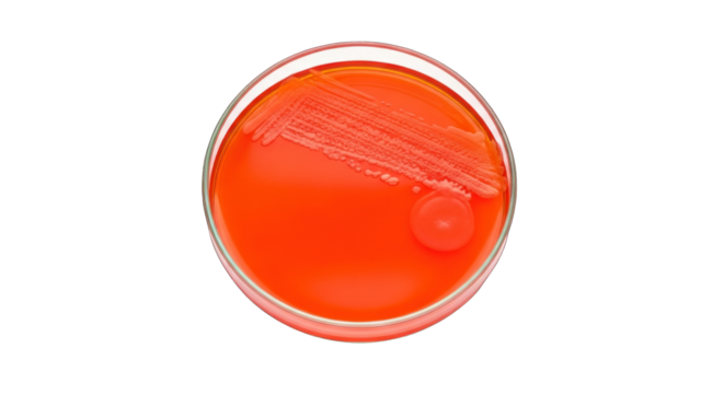 Bacterial Culture in Petri Dish.