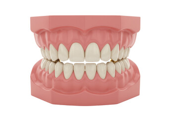 Isolated full set of teeth, model representing human gums and teeth, orthodontic tool