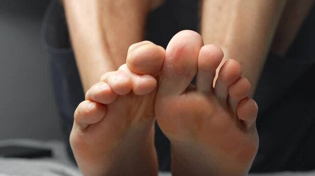 Fungal infection on the feet of humans.
Foot health problems and severe itching.
Treatment of foot fungus and infection management.
Men's heels.
Health, medicine, germs, stink, fungus, doctor