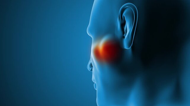 Human Parotid Gland Neoplastic Growth