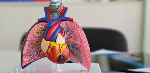 Lung cancer asthma, chronic obstructive pulmonary disease or COPD and bronchitis concept