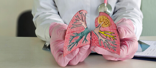 Doctor with smoker and normal lung anatomy for disease. Lung cancer and asthma concept