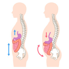 内臓下垂　内臓の位置が下がっている状態