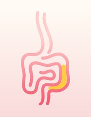 Healthcare imagery about colitis and bloating