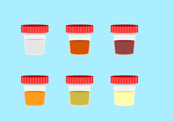 urine color test on background and color of urine tell the health of human 
