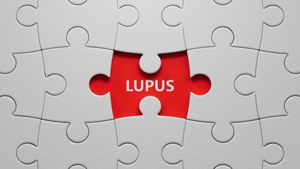 Fototapeta premium The word LUPUS is written on puzzle pieces with missing pieces. Medical concept.close up of puzzle pieces with missing pieces,Business Concept.3D rendering.