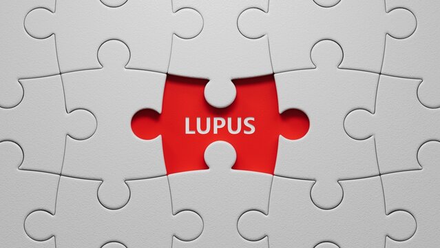 The word LUPUS is written on puzzle pieces with missing pieces. Medical concept.close up of puzzle pieces with missing pieces,Business Concept.3D rendering.