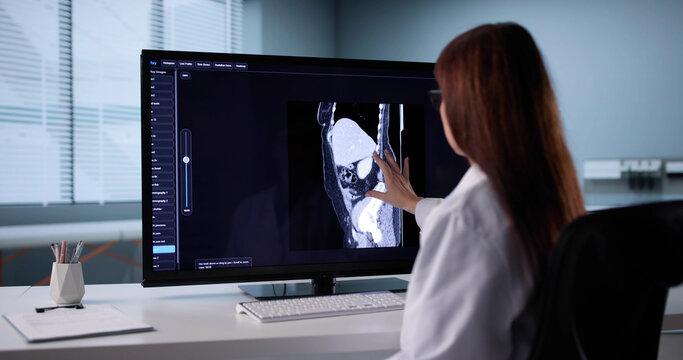 Skilled Surgeon Analyzes MRI Xray On Desktop Computer