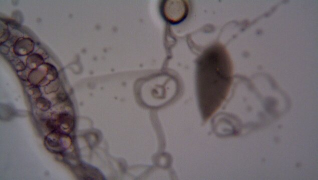 Examination of blood samples revealing malaria parasite stages in human red blood cells, focusing on morphology and diagnostic importance