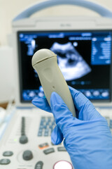 An ultrasound machine shown in close-up in a veterinary clinic. Concept diagnostic imaging
