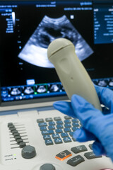 An ultrasound machine shown in close-up in a veterinary clinic. Concept diagnostic imaging