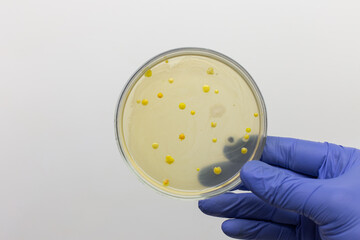Isolation of bacterial cells on medical agar in a petri dish, petri dish in the hand of a scientist...