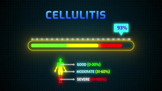 Cellulitis Severity Risk Meter Animation | Digital HUD with Percentage Counter and Human Silhouette Infographic 4k video