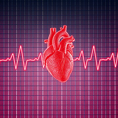 A stock photo depicting a medical ECG showing signs of atrial fibrillation , Heart, rhythm, ECG, cardiology, heartbeat