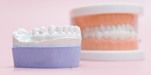 Dental Stone Cast and Full Denture Model on Pink Background