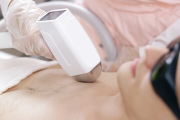 Laser chest hair removal on male chest in clinical setting