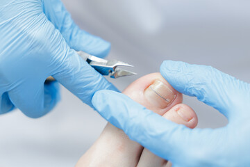 Care pedicure banner, white light background. Process Podiatrist treating foot of patient woman