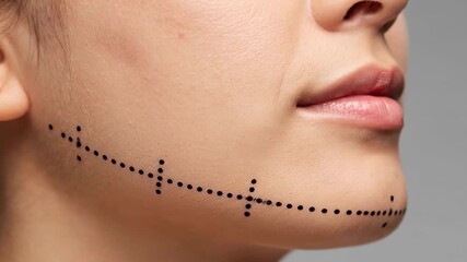 Facial contouring guide A close-up of a face with pre-marked lines for cosmetic procedures